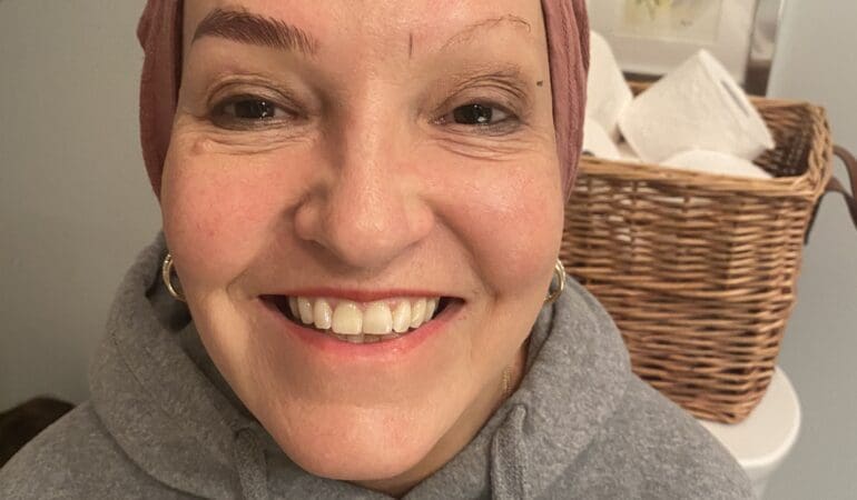 eyebrows
