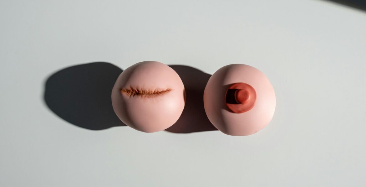 lumpectomy