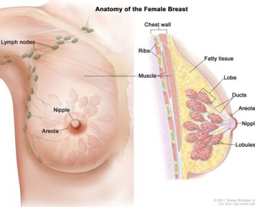 occult breast cancer