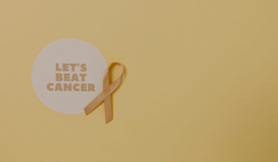 radiation treatment