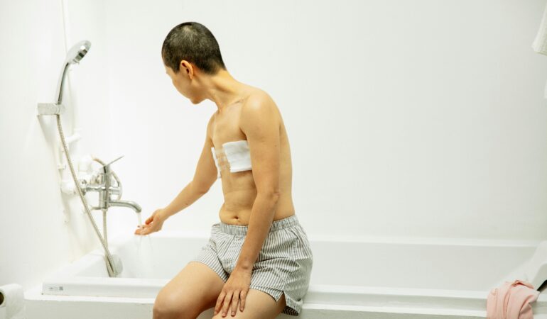 Double mastectomy