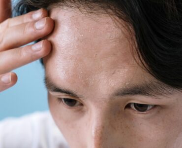 trauma responses after cancer