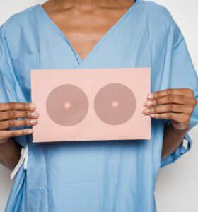 AI in Breast Cancer Screening